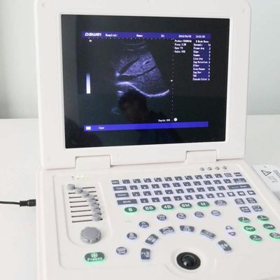 qualité GYN Factory Supply Dw580 Portable Ultrasound Machine For Sale usine
